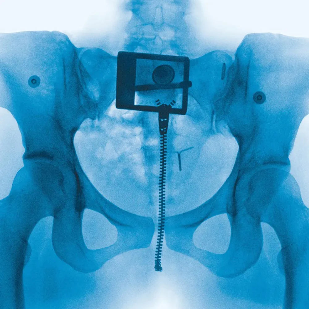 Lorde - Virgin (X-Ray Vinyl)